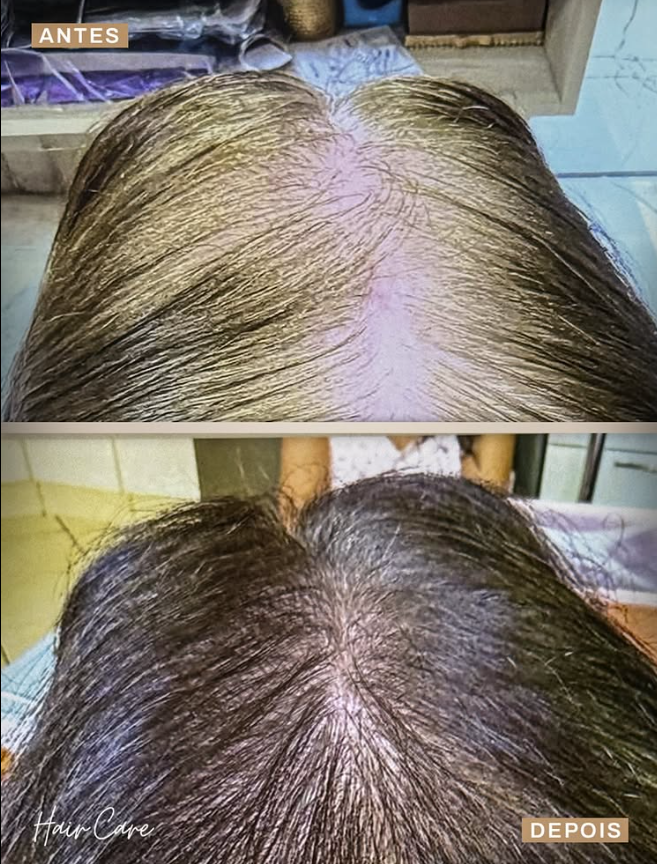 Antes e Depois - Caso 2